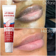 Exfoliating Lip Balm