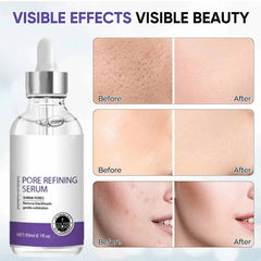 Pore Shrinking Serum